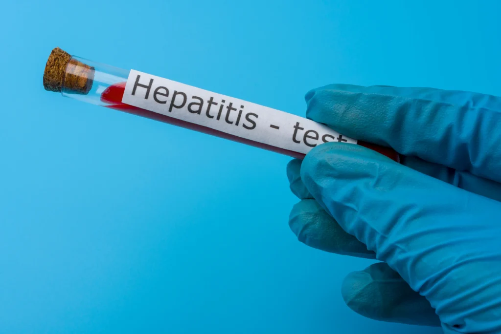 Hepatitis C 