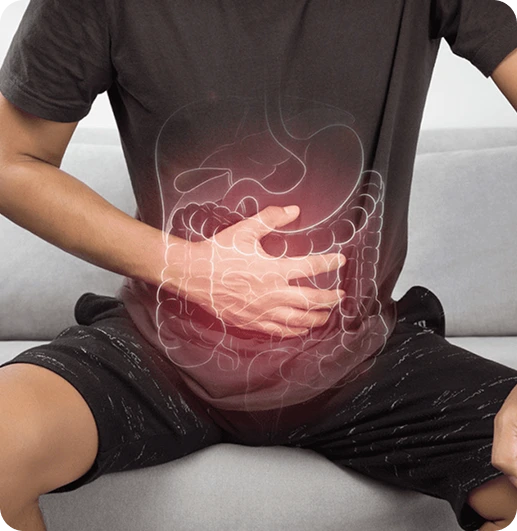 colon cancer