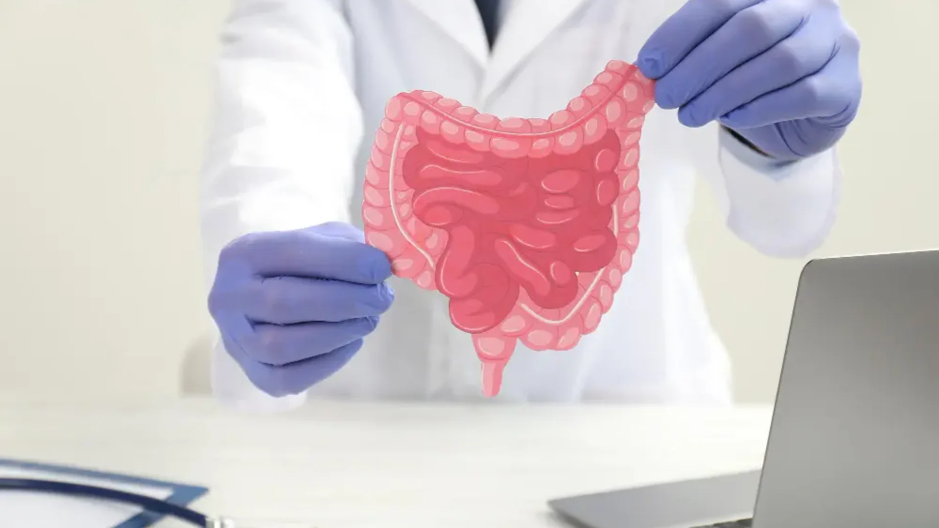 Polyp Cancer
