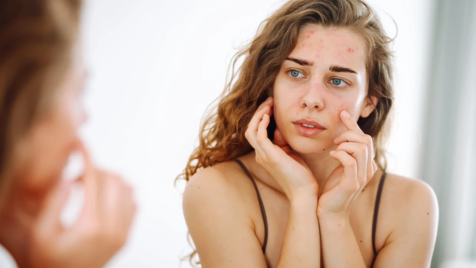 Skin Problem